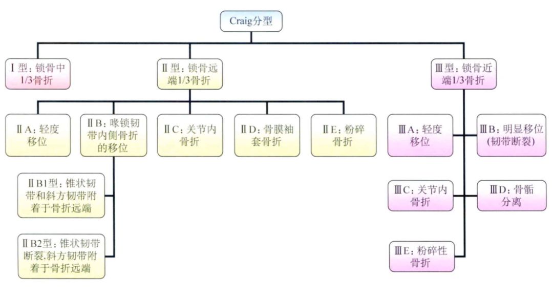 锁骨骨折Craig分型