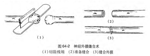 image-20200813135102942