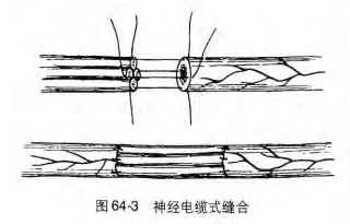 image-20200813135255367
