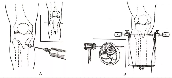 image-20200817143419064