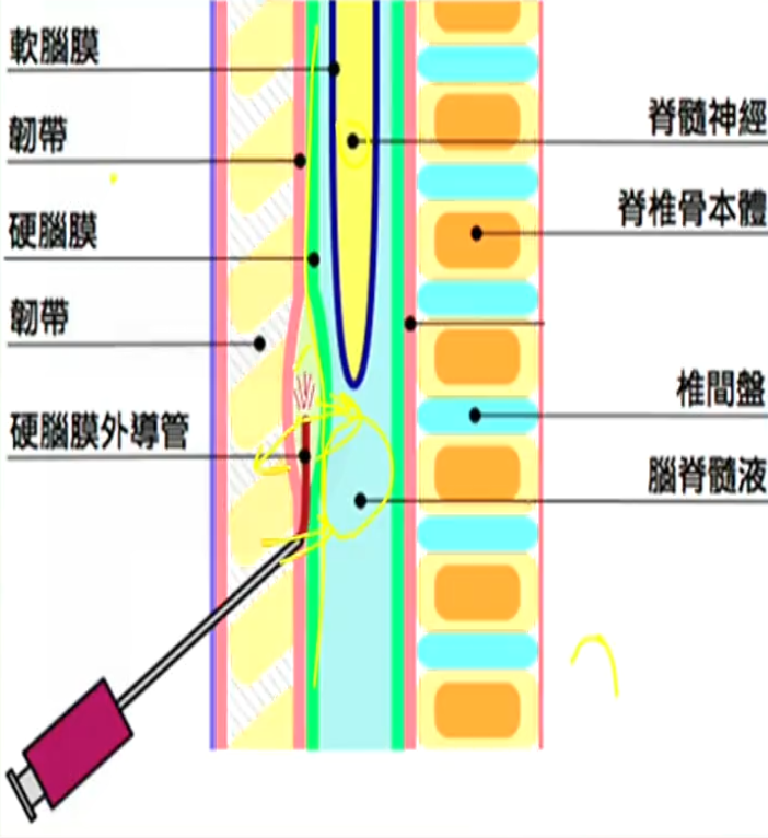image-20200817170313668