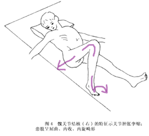 image-20200918064529719