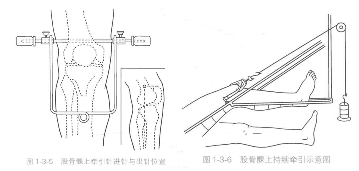 image-20220422202558436