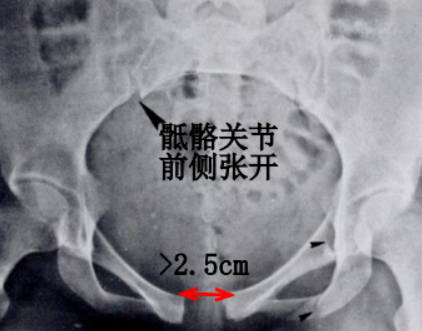image-20220717131701014